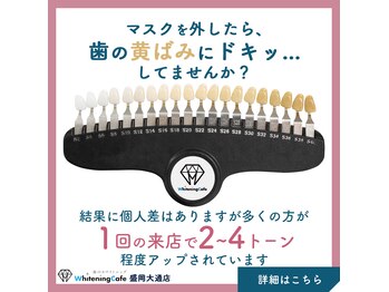 ホワイトニングカフェ 盛岡大通店(WhiteningCafe)