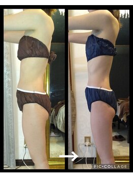 ラキュア(La Cure)/さらにボディーライン整えます！