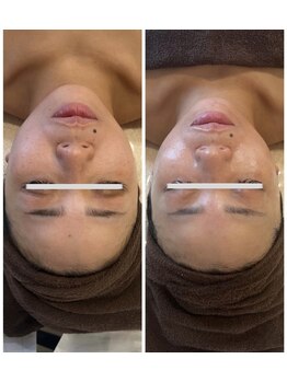 ルミナス(luminous)/目周りの黒ずみと揺らぎ肌改善