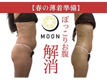 ムーン(MOON)