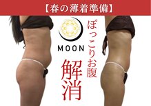 ムーン(MOON)