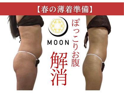 ムーン(MOON)の写真