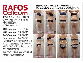 ソルティ 寺田町(Salty)/【モニター写真】