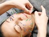 人気NO1【美容鍼】年齢に負けない美肌習慣くすみ、たるみ、ほうれい線90分