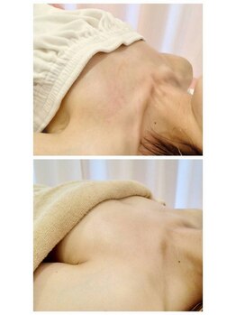 ククー(coucou)/痩せ型さんのバスト変化