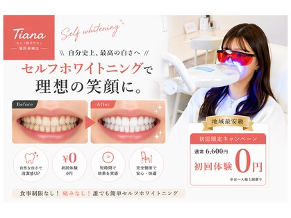 ティアナ 福岡香椎店(Tiana)の写真