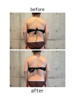 エレン(ellen)/パワーレメディB/A