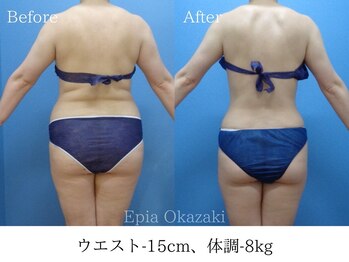 エピア 岡崎店(Epia)/自力では難しい部分ケア