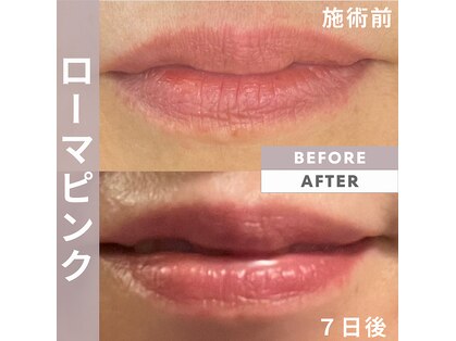 プルネ(Purune)の写真