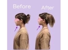 ビーホリック(Bholic)/