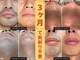 ラッシュ(RUSH)の写真
