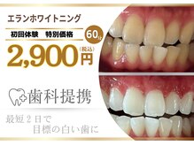 エランホワイトニング 一社店