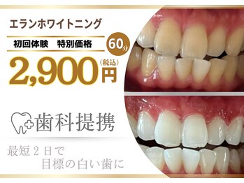 エランホワイトニング 一社店