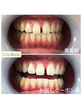 ルブラン 奈良店(Le Blanc)/口コミで広がる