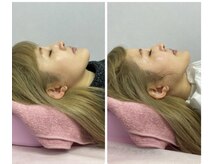 ノゾミジュク(希美熟 NOZOMIJUKU)/オプション☆顎下