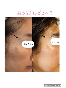 シュエットサロン 自由が丘(Chouette Salon)/さよなら~