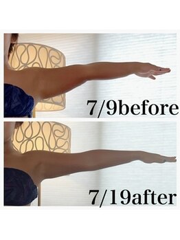 ウラヤス 恵比寿(Urayasu)/二の腕もスリムに