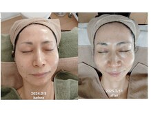 心音/シャープなフェイスラインへ。