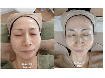 心音/シャープなフェイスラインへ。