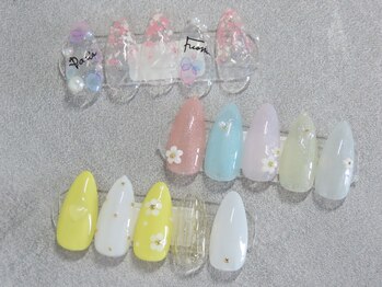 ミルフルール 宇土店(Mille Fleurs)/定額シンプルコース/美フォルム