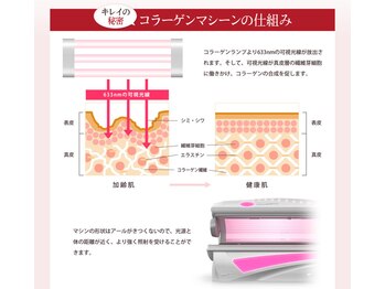 にしむら整骨院/コラーゲンマシンの仕組み