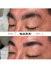 ナークス(NARX)/メンズ眉毛脱毛（デザイン込み）
