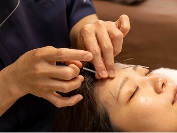 あかり鍼灸接骨院の写真/【土山駅徒歩２分】早い効果を実感！美容鍼お試しあり￥3980！たるみケア・むくみ・シワ改善◎　