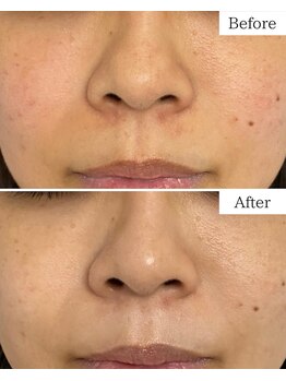 シャムリー(SHAMRY)/SEN管理