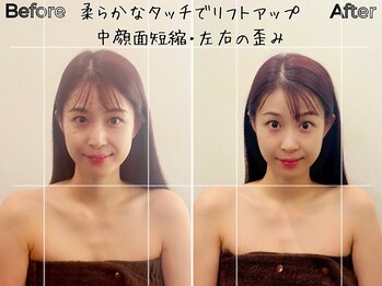 リストアハート(Restore Heart)/リフトアップ、むくみ解消♪