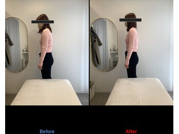 リン 大宮院(RIN)/体験骨膜整体1回の変化