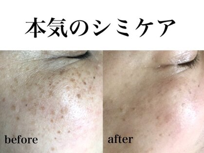 パルサロン(palsalon.)の写真