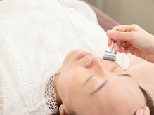 マチコ鍼灸院/美肌ローラーはり