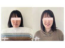 スタイルキューピット(style cupit)/メイクビフォアフター＊30代