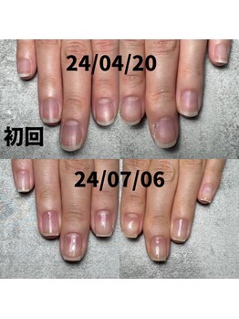 ３ヶ月でこの変化♪