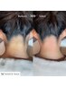 【お得なSET】全顔フェイシャルワックス＋うなじワックス