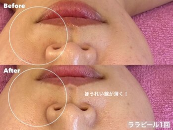 ルチア 博多店(Lucia)/お肌の基礎を整える！