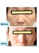 リオンズ 千葉アリオ柏店/おススメのエイジングケア