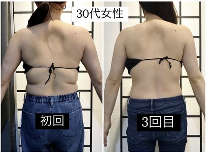 リメイクボディ センダイ(Re.Make Body SENDAI)の写真