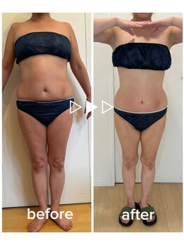 ビーアンベリィ(bee embellie)/50代お客様！－7kg！