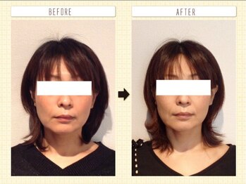 美容整体 ウェリナ 蟹江院/小顔矯正/骨盤矯正/痩身整体