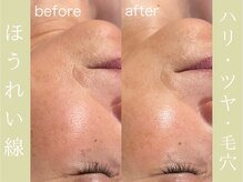 健志接骨院/πテラピー造顔メソッド