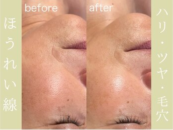 健志接骨院/πテラピー造顔メソッド