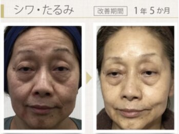 ヴィーナスハンド/東日本地区別ファイナリスト受賞