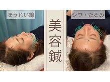 ファミリア鍼灸接骨院