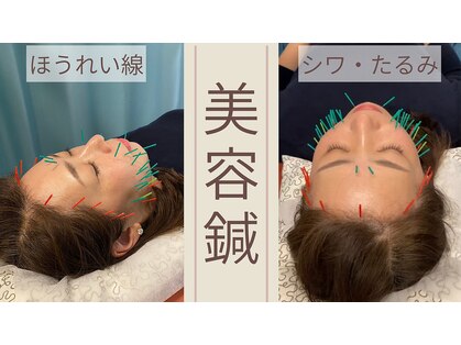 ファミリア鍼灸接骨院の写真