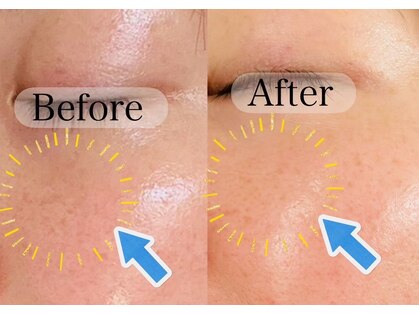 シンシア(Sincere.)の写真