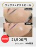 【ビビビ祭におすすめ】ワックス脱毛×ダクトピールでツヤ肌・透明感UP