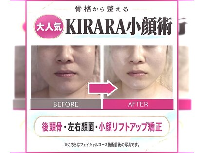 キララ 美容矯正の写真