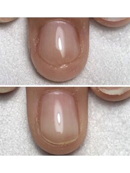 ディアリリー(Dia Rily)/深爪Before＆after