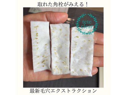 ミミ(mimi)の写真